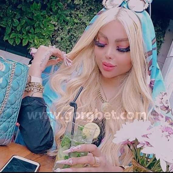 عکس های نگار رکنی قبل از عمل زیبایی